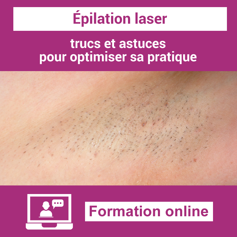 20/03/26 - Épilation laser : Trucs et astuces pour optimiser sa pratique