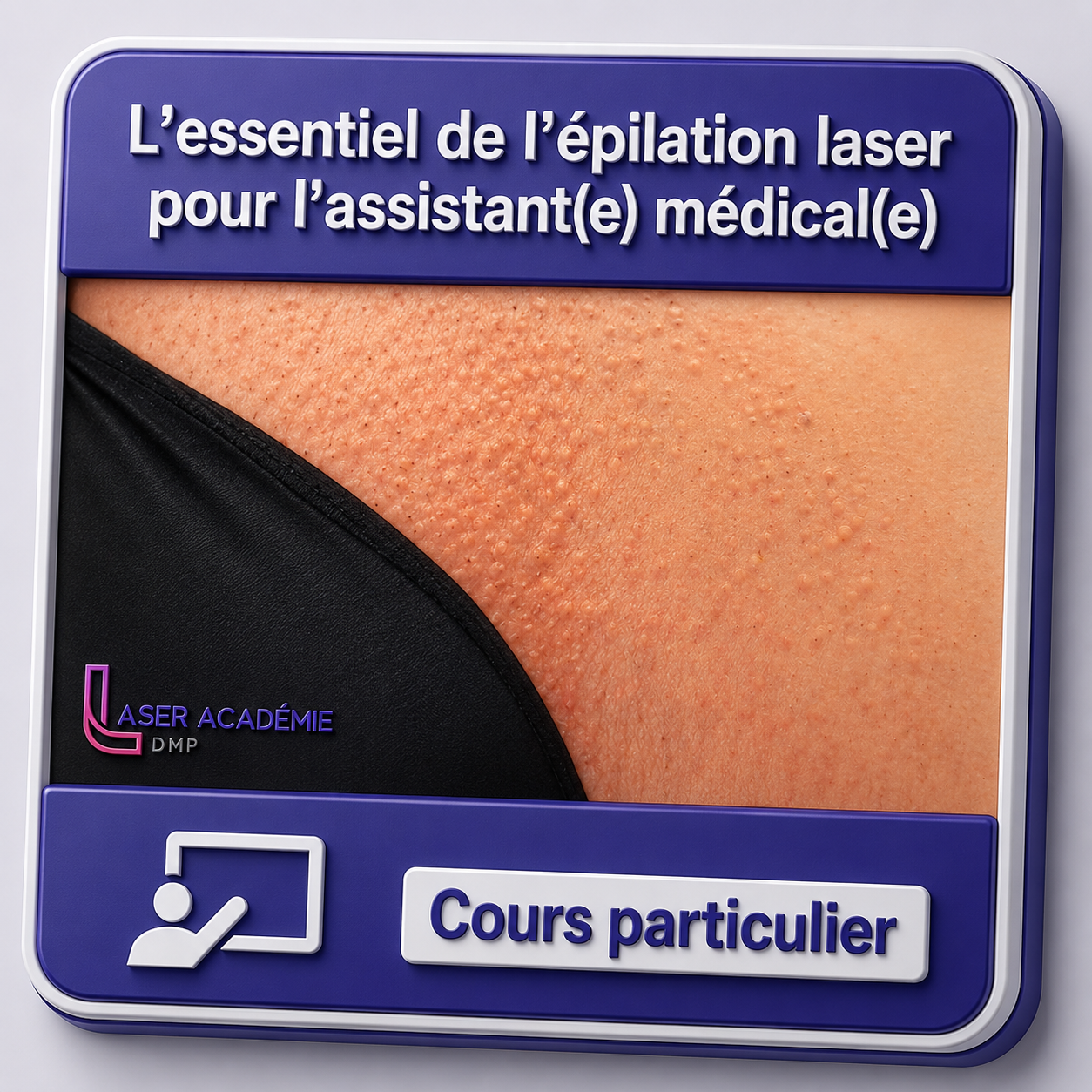 L'essentiel de l'épilation laser pour l'assistant(e) médical(e)